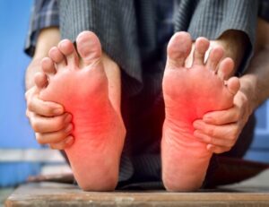 a patient showing their inflamed feet