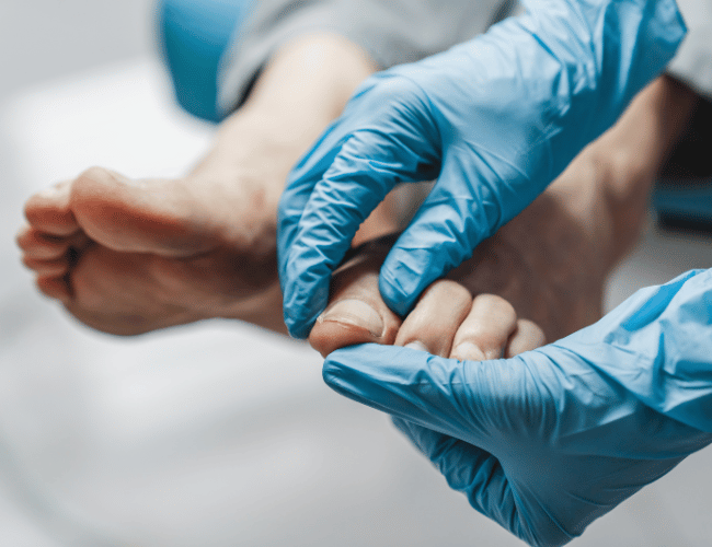 Podiatrist examining the toenail of a diabetic patient