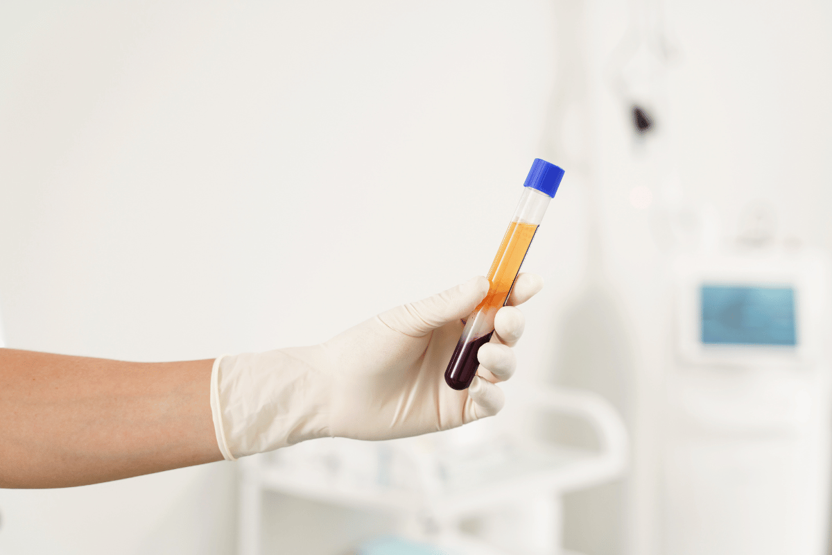 Platelet Rich Plasma of a patient